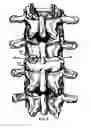 Fig. 07 - Interbody cage system