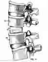 Fig. 09 - Interbody cage system