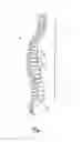 Fig. 02 - Vertebral fusion device and method