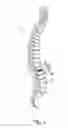 Fig. 03 - Vertebral fusion device and method