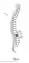 Fig. 04 - Vertebral fusion device and method