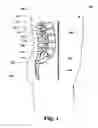 Fig. 02 - Intervertebral prosthetic disc and method of installing same