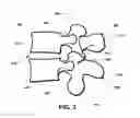Fig. 04 - Intervertebral prosthetic disc and method of installing same