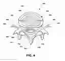 Fig. 05 - Intervertebral prosthetic disc and method of installing same
