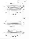 Fig. 15 - Intervertebral prosthetic disc and method of installing same