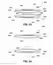Fig. 18 - Intervertebral prosthetic disc and method of installing same