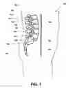 Fig. 02 - Intervertebral prosthetic disc