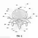 Fig. 04 - Intervertebral prosthetic disc