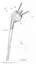 Fig. 02 - Shoulder arthroplasty system