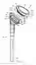 Fig. 08 - Shoulder arthroplasty system