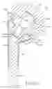 Fig. 17 - Shoulder arthroplasty system