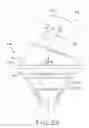 Fig. 23 - Shoulder arthroplasty system