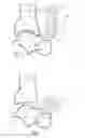 Fig. 03 - Surgical instrumentation kit for inserting an ankle prosthesis