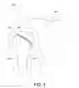 Fig. 05 - Bonding system for orthopedic implants