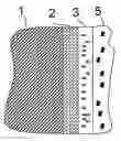 Fig. 01 - Implant and method of producing the same, and a system for implantation
