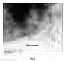 Fig. 03 - Implant and method of producing the same, and a system for implantation