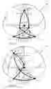 Fig. 05 - Center robotic arm with five-bar spherical linkage for endoscopic camera