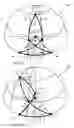 Fig. 05 - Center robotic arm with five-bar spherical linkage for endoscopic camera