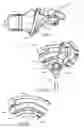 Fig. 08 - Center robotic arm with five-bar spherical linkage for endoscopic camera
