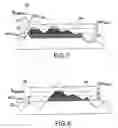 Fig. 05 - Topographic map display device for aircraft