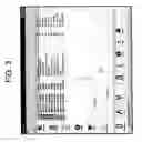 Fig. 04 - Filtering device and filtering method