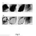 Fig. 06 - Transgenic expression constructs for vegetative plant tissue specific expression of nucleic acids
