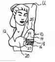 Fig. 01 - Under arm/breast perspiration shields