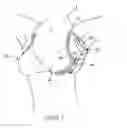 Fig. 04 - Under arm/breast perspiration shields