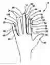 Fig. 01 - Surgical glove system