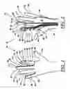 Fig. 02 - Surgical glove system