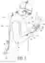 Fig. 04 - Surgical glove system
