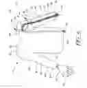 Fig. 05 - Surgical glove system