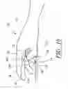 Fig. 08 - Surgical glove system