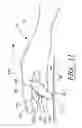 Fig. 09 - Surgical glove system