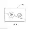 Fig. 85 - Hospital bed