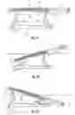 Fig. 11 - Hospital bed