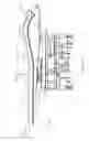 Fig. 04 - Chair stabilizer for refractive surgery