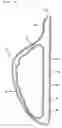 Fig. 05 - Cleaning device and holding member used for the same