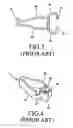 Fig. 03 - One-piece elastic clamp device