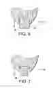 Fig. 05 - Bowling pin re-manufacturing process