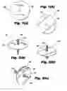 Fig. 02 - Self-stick metal plate and method of applying the same