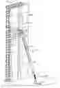 Fig. 01 - RETRACTABLE BRACE