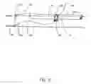 Fig. 03 -  Ocean-based device for loading and unloading of ships