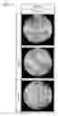 Fig. 05 - Silicon wafer and method for producing same