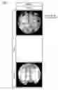 Fig. 07 - Silicon wafer and method for producing same