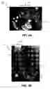 Fig. 05 - Multi-functional fabric covered elastic tether and associated method