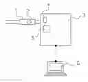 Fig. 02 - Process and device for operating a respiration system