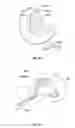 Fig. 16 - High flow therapy device utilizing a non-sealing respiratory interface and related methods