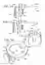 Fig. 16 - Dispensing device