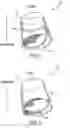 Fig. 02 - Nasal air purifier